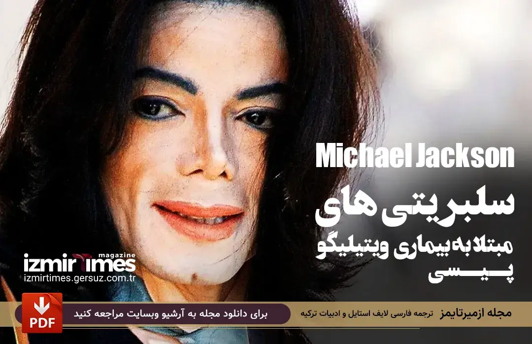 مایکل جکسون (Michael Jackson)  افراد مشهور مبتلا به ویتیلیگو (پیسی)