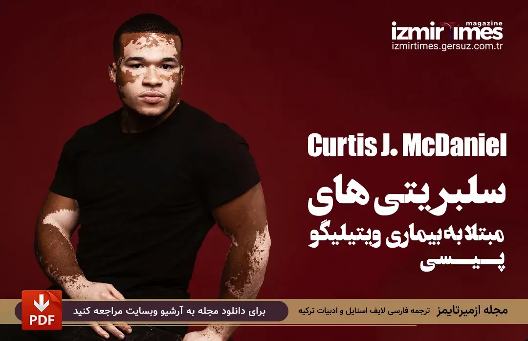 کرتیس جی مک دانیل Curtis J. McDaniel مدل مشهور مبتلا به ویتیلیگو (پیسی)